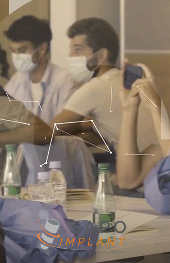 Sapo Implant – All on 4/6