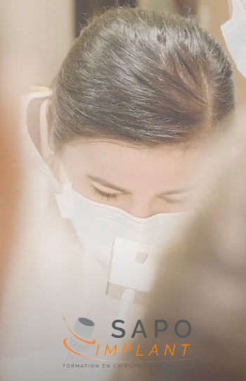 Sapo Implant – L’anatomie et l’implant